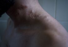 Supervivientes de tortura: “Nos quemaban con cigarrillos, nos violaban, nos meaban”